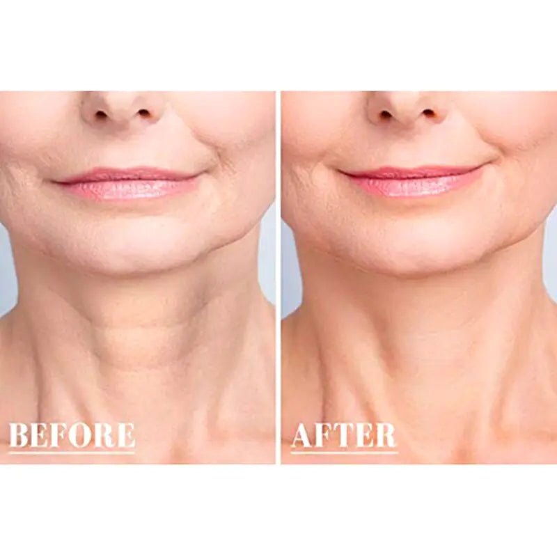 Reusable Anti Wrinkle Chest - Galaxy Cart