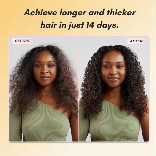 Veganic Luxurious Hair Growth Oil - Galaxy Cart