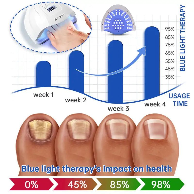 Fungus Laser Therapy Device - Galaxy Cart