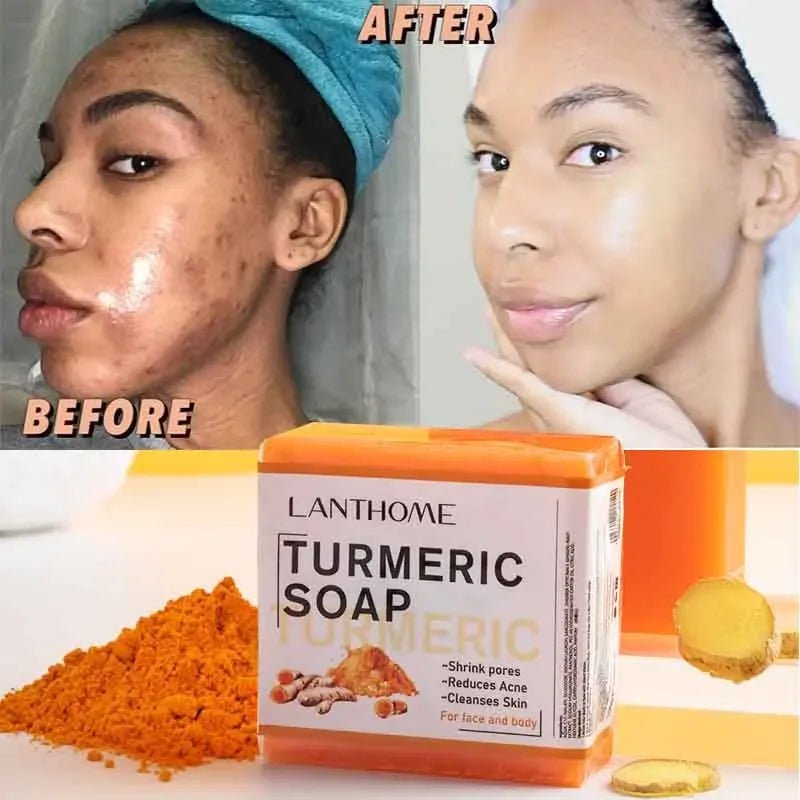 Turmeric Soap Face Cleansing Anti Acne - Galaxy Cart