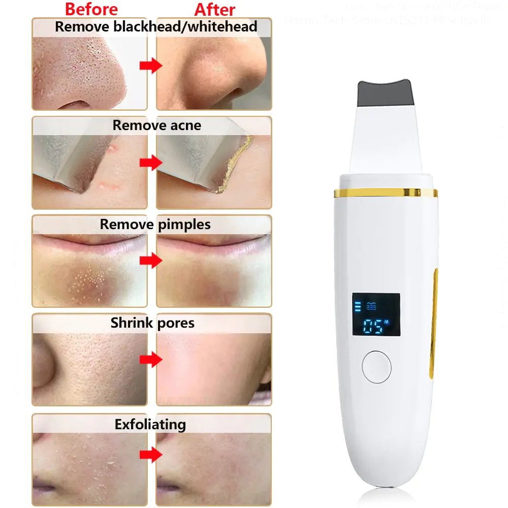 Ultrasonic Skin Scrubber: Facial Cleansing - Galaxy Cart