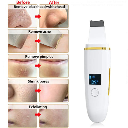Ultrasonic Skin Scrubber: Facial Cleansing - Galaxy Cart