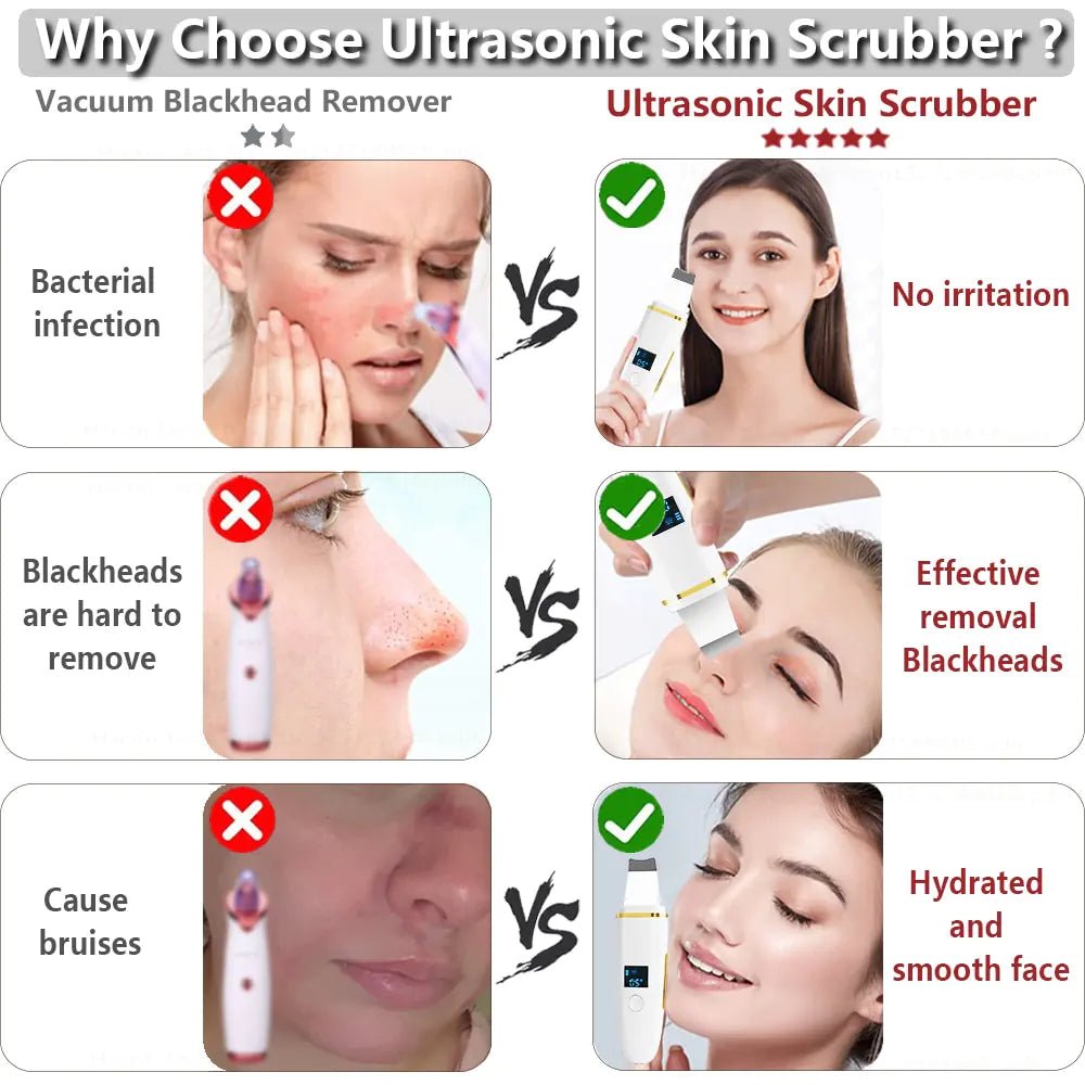 Ultrasonic Skin Scrubber: Facial Cleansing - Galaxy Cart