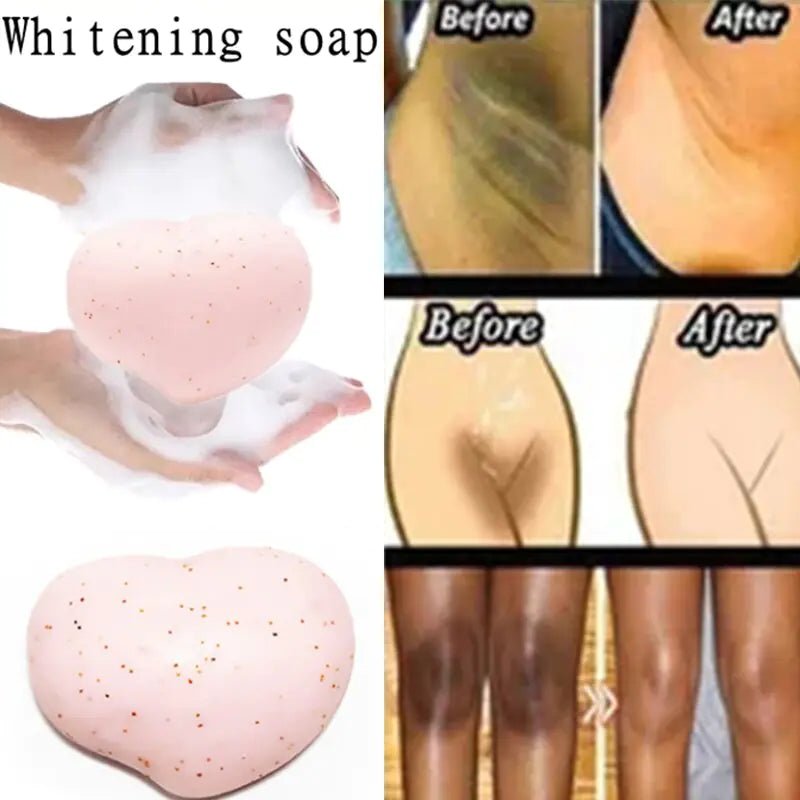 Whitening Soap: Body Care Solution - Galaxy Cart